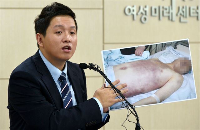 31일 오후 서울 영등포구 군인권센터에서 임태훈 소장이 지난 4월 선임병들에게 집단구타 당한 후 사망한 28사단 윤아무개(23) 일병 사망사건과 관련 현안 브리핑 중 일부 사진을 공개하고 있다. 뉴시스