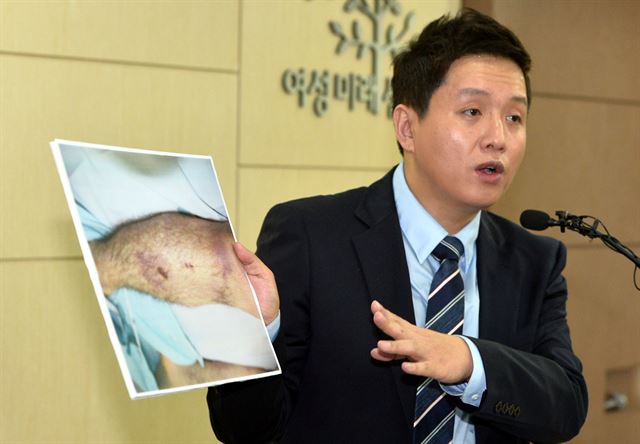 31일 오후 서울 영등포구 군인권센터에서 임태훈 소장이 지난 4월 선임병들에게 집단구타 당한 후 사망한 28사단 윤아무개(23) 일병 사망사건과 관련 현안 브리핑 중 일부 사진을 공개하고 있다.뉴시스