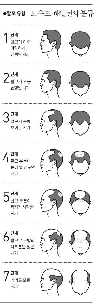 탈모는 가을철 취업 시즌을 앞둔 젊은이들에게 큰 고민거리가 되고 있다. 한국일보 자료사진