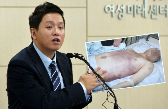 군인권센터에서 임태훈 소장이 선임병들에게 집단구타 당한 후 사망한 28사단 윤일병 사망사건과 관련 현안 브리핑 중 일부 사진을 공개하고 있다. 한국일보 자료사진