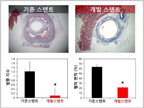 한동근 한국과학기술연구원(KIST) 박사 연구팀이 개발한 스텐트와 기존 약물방출 스텐트를 4주간 돼지 동물실험한 결과 염증과 재협착율이 현저히 낮아졌다. KIST 제공