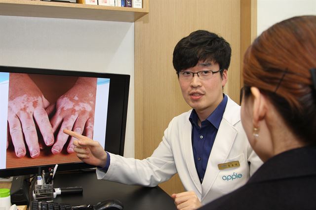 정홍대 피부과 전문의가 백반증으로 내원한 환자에게 백반증이 생긴 환자의 사례를 보여주고 있다.(사진제공-대구 애플피부과)