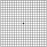 암슬러 격자. 당뇨병성 황반부종에 걸린 환자의 눈에는 바둑판 모양의 격자가 시간이 지날수록 휘어져 보이고 검은 반점이 보이게 되며 갑자기 시력이 떨어진다.
