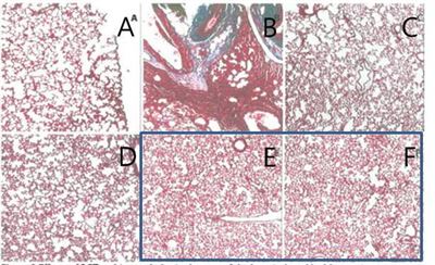 블레오마이신 투여로 콜라겐 침전과 같은 폐조직의 조직병리학적 변화를 유발한 집단에게 PGT를 투여하자 폐섬유화 정도가 완화된 모습. (A-정상 대조 그룹, B-블레오마이신 그룹, C-블레오마이신-덱사메타손 그룹, D-블레오마이신-PGT 157㎎/㎏투여 그룹, E-블레오마이신-PGT 314㎎/㎏ 투여그룹, F-블레오마이신-PGT 785㎎/㎏투여그룹) 편강한의원 제공
