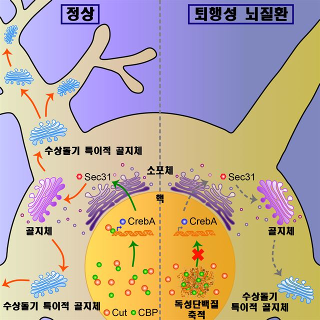 정상인(왼쪽)의 뇌신경세포와 퇴행성 뇌질환 환자의 뇌신경세포. 디지스트 제공