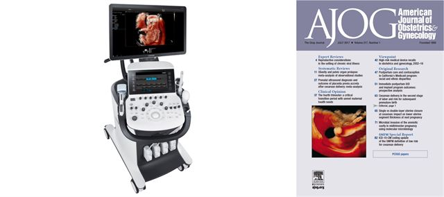 크리스털 뷰 기술이 탑재된 초음파 진단기 WS80A(왼쪽)와 이 기술로 스캔한 영상이 게재된 미국 산부인과 학술 저널 7월호 표지. 삼성전자 제공