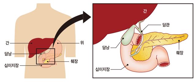 담낭 이미지. 강동경희대병원 제공