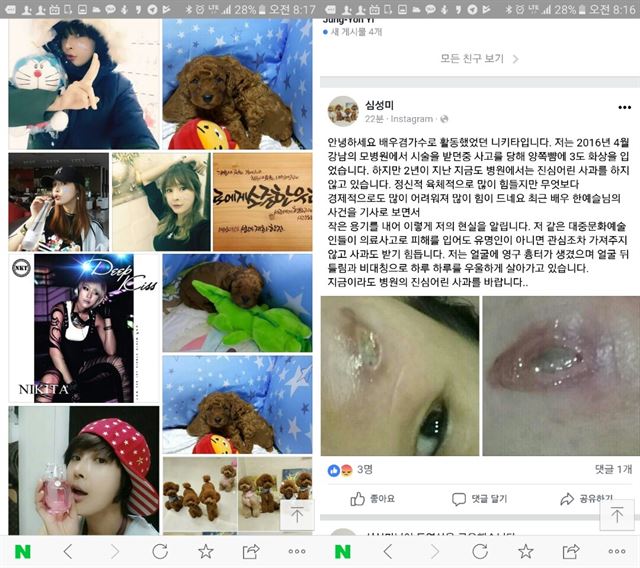 심성미씨의 페이스북 사진. 왼쪽은 예명 '니키타'로 활동하던 시절. 오른쪽은 26일 의료사고로 얼굴에 영구적인 흉터가 남게 됐다며 올린 글과 사진이다. 심성미씨 페이스북 캡처