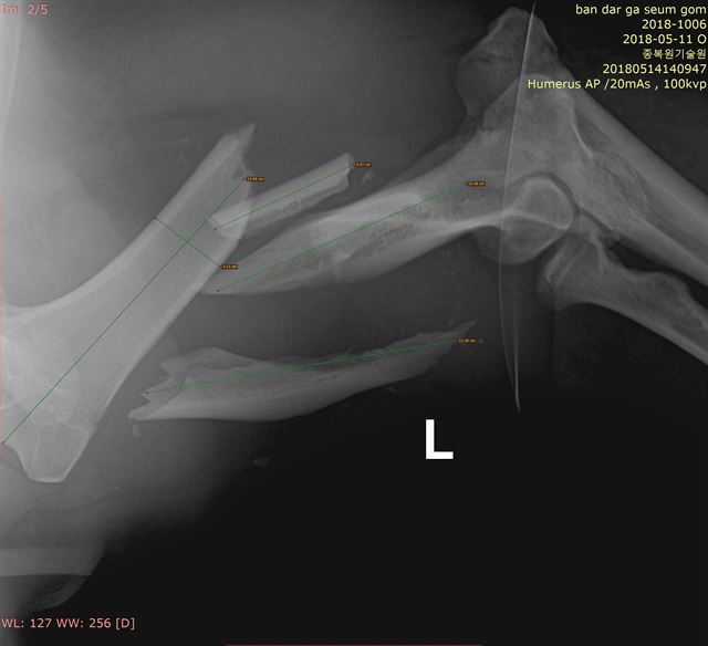교통사고를 당한 반달가슴곰 KM53의 복합골절부위 엑스레이 사진. 환경부 제공