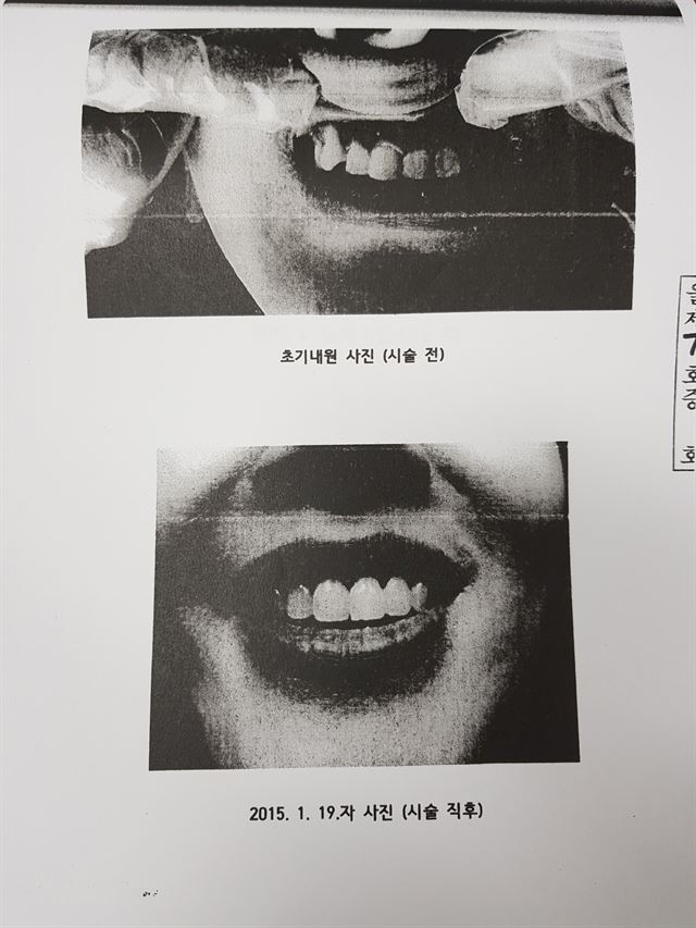 속초 S치과 원장의 변호를 맡은 L법률사무소가 이씨의 치료 후 모습이라며 법원에 증거로 제출한 사진(아래 사진). 그러나 이씨는 “마치 치약 광고에 나오는 여성의 사진 같다. 결코 내 사진이 아니다”라고 주장했다. 제보자 제공