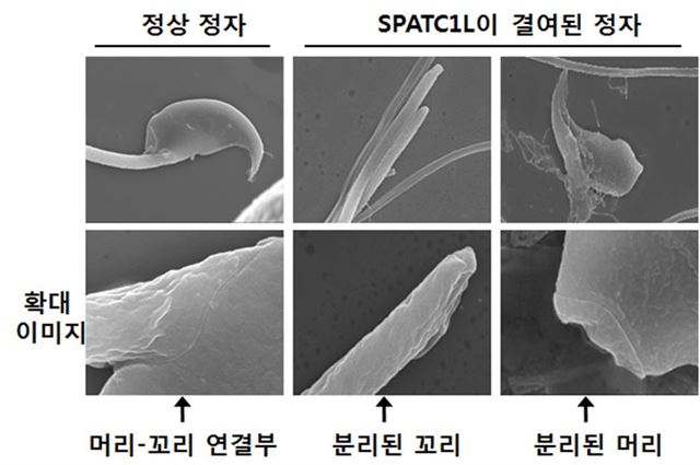 SPATC1L 단백질이 정상 작용한 쥐(왼쪽)과 달리 단백질 기능을 억제한 쥐에선 정자의 머리와 꼬리가 분리되는 것으로 나타났다. 광주과학기술원 제공