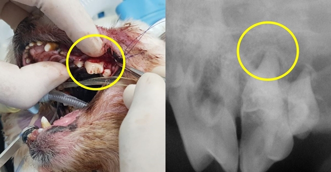 치아 뿌리 노출이 심각한 치근농양 치아(왼쪽 노란 원), 치과 방사선 사진에서 치근농양을 확인할 수 있었다.