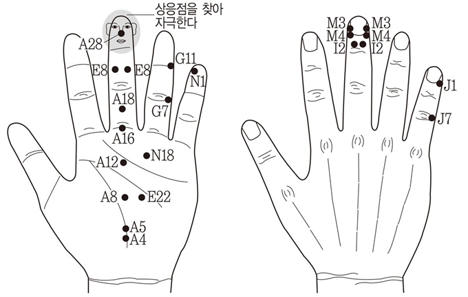 입 눈 돌아가는 구안와사가 생기면