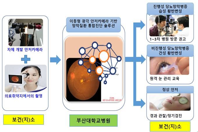 안저카메라 기반 진단서비스 개념도.