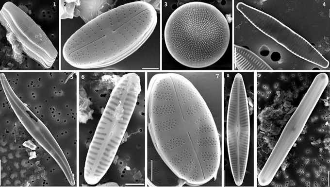 미기록종 돌말류 전자현미경 사진. 윗줄 왼쪽부터 아크난데스 시넨시스, 아크난티디움 아토무스. 에드테리오티아 구이조이아나, 프라질라리아 레카피텔라타, 아랫줄 왼쪽부터 자이로시그마 프로세룸. 피눌라리아 라벤호스티, 플라테사 발시, 나비큘라 니포니카, 피눌라리아 슈도타벨라리아. 국립낙동강생물자원관 제공