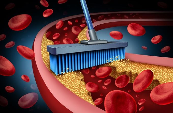 이상지질혈증 환자 1,100만명 시대이지만 약을 복용하는 환자는 30%밖에 되지 않을 정도로 병 인지도가 아직 낮은 편이다. 게티이미지뱅크