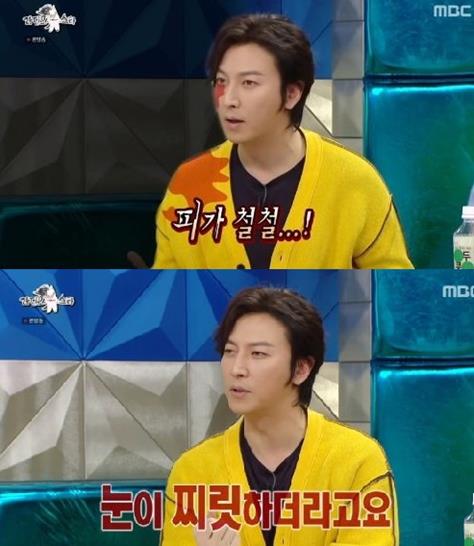 ‘라디오스타’ 박건형이 실명 할 뻔한 사건을 언급했다.MBC 방송캡처