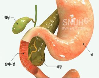 췌장과 십이지장.