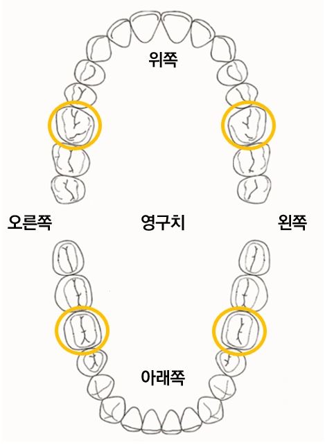 제1 대구치 위치. 서울대치과병원 제공