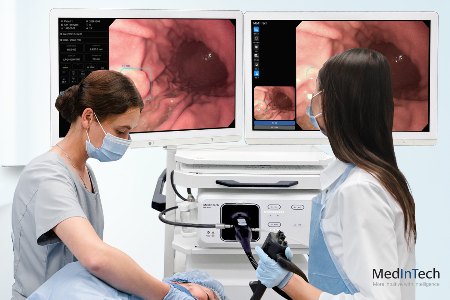 AI 기술 활용 '내시경 자동화' 기반 강화, 새 표준 제시 - 뉴스 썸네일 이미지