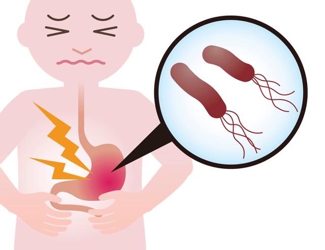 위암으로 가는 '중간 단계'인 위축성 위염은 헬리코박터 파일로리 균의 감염이 가장 큰 원인으로 꼽힌다, 게티이미지뱅크