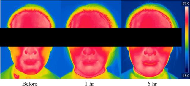 마스크 착용 전보다 착용 후 1시간이 지난 뒤 피부 온도가 높아지고 높아진 상태로 6시간까지 유지되는 모습이 확인된다. 아모레퍼시픽 제공