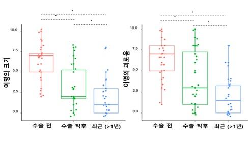 수술 전후 이명의 크기와 이명의 괴로움 정도를 비교 평가한 결과