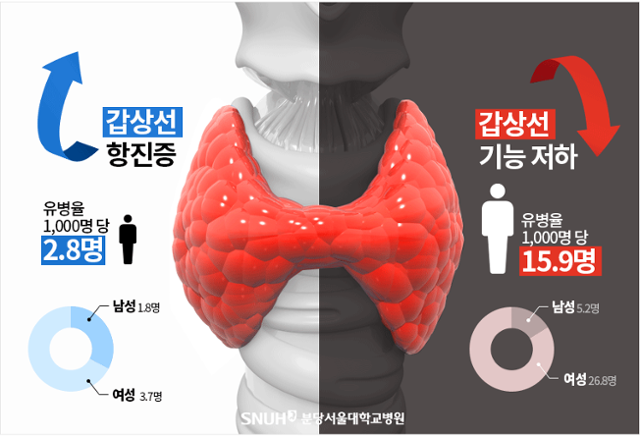 갑상선기능항진증과 갑상선기능저하증 비교