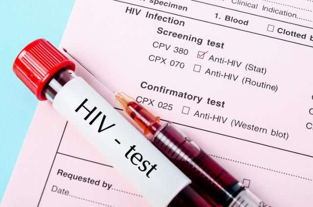 코로나19 대유행 여파로 HIV 무료 검사가 중단되면서 HIV 감염 관리에 빨간불이 커졌다. 게티이미지뱅크