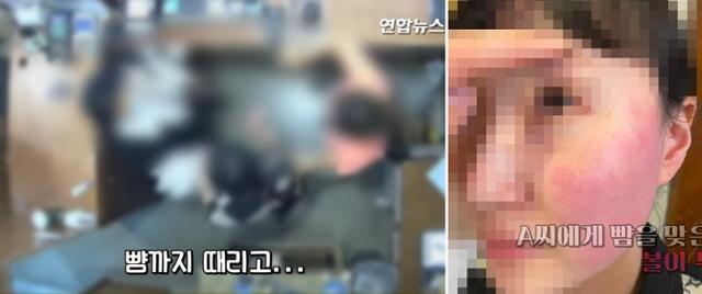 폭행 혐의로 경찰 조사를 받고 있는 주한 벨기에 대사 부인에게 뺨을 맞은 피해자인 옷 가게 점원과 가족이 볼이 부은 사진과 폭행 당시 CCTV 영상을 20일 공개했다. 연합뉴스