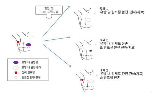 림프절 전이 HER2 양성 유방암에서 선행 치료에 따른 유방 및 림프절 관해(치료) 결과 예시