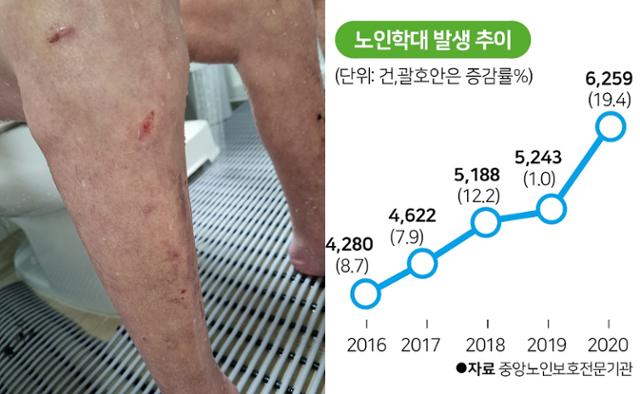 경기 광주의 한 요양병원에 한달간 입원해 있던 70대 남성 온몸 곳곳에 멍과 상처가 나 있다. 가족 제공