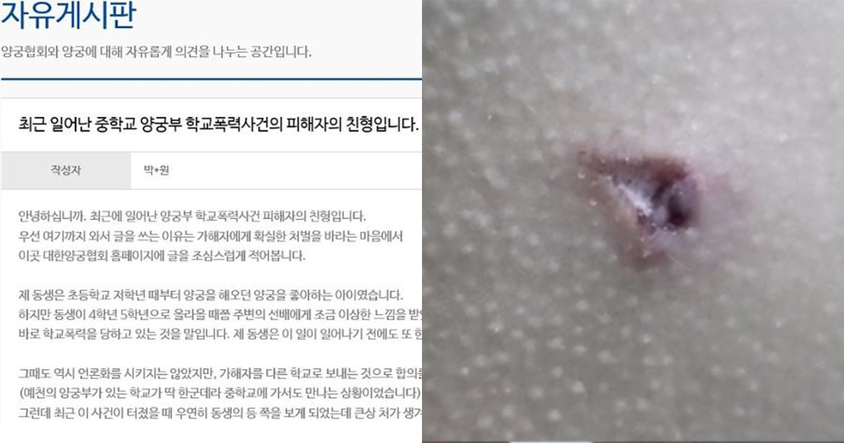 "동생에 활 쏜 가해자, 확실히 처벌해야"… 친형의 호소 - Vimarsana News