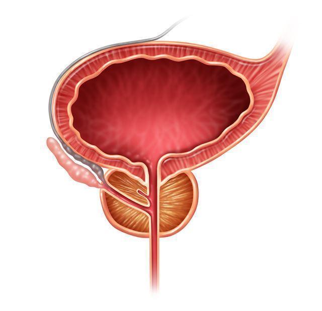 급속한 노령화와 서구화된 식습관으로 남성 암 가운데 유일하게 전립선암만 늘어나고 있다. 게티이미지뱅크