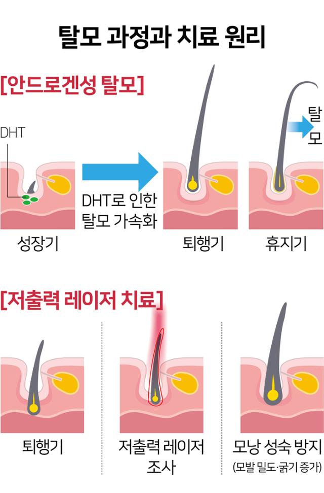 모낭 염증 상태의 치료를 희망하는 경우는, 「이것」을 확인해 주세요. 2