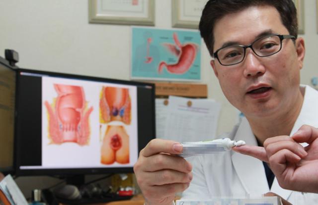 성분불명 치질연고, 자칫하면 수술대 신세-지역ㅣ한국일보
