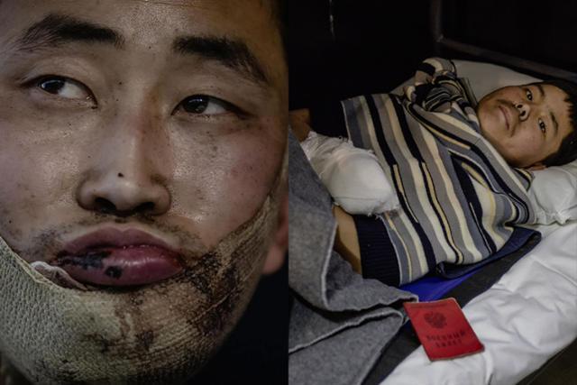 North Korean prisoners of war identified as Ri, left, and Paek are seen after their capture in 2025. Both had sustained serious injuries at the time, and are shown receiving treatment at an undisclosed location in Kyiv, Ukraine. Captured from Ukrainian President Volodymyr Zelenskyy’s social media